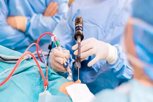 Endoscopic Sinus Surgery