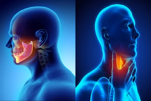 Head And Neck Cancers