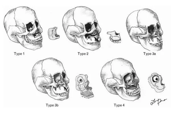 Head and Neck Surgeries